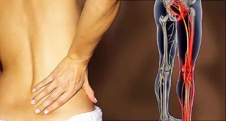 backpain-3